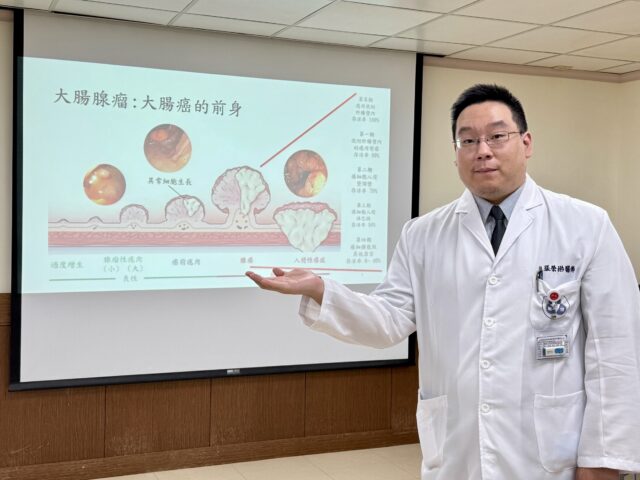 台灣新聞通訊社-大腸癌早期症狀常被忽略 醫師籲高風險族群定期檢查