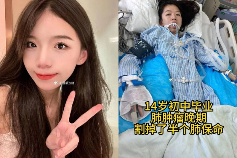 台灣新聞通訊社-美女網紅驚傳肺癌過世得年26歲！哥哥悲慟證實：願天堂沒有痛苦