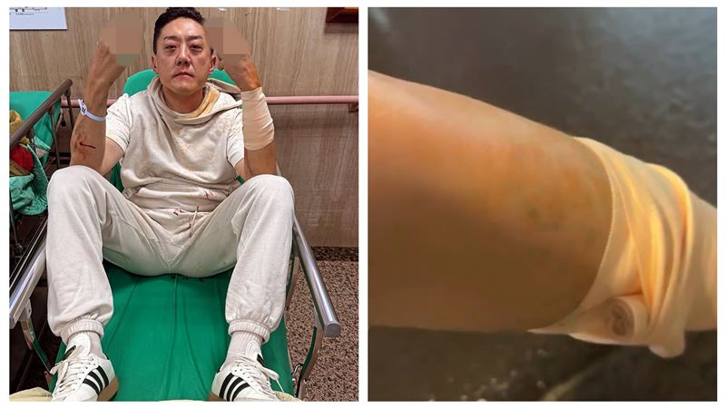 台灣新聞通訊社-新/埋伏砍殺夜店大亨夏天倫 北市警逮1名男子 行兇動機釐清中