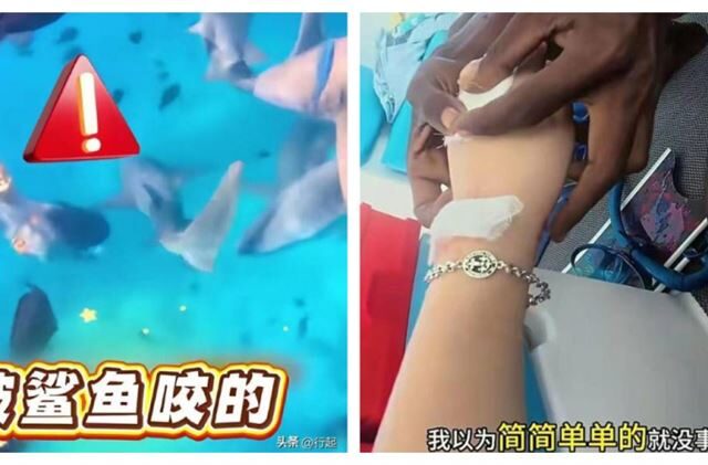 台灣新聞通訊社-女子馬爾地夫潛水被鯊魚咬傷！她生理期潛水被咬討拍遭炎上