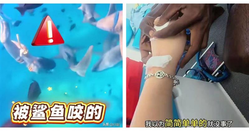 台灣新聞通訊社-女子馬爾地夫潛水被鯊魚咬傷!她生理期潛水被咬討拍遭炎上