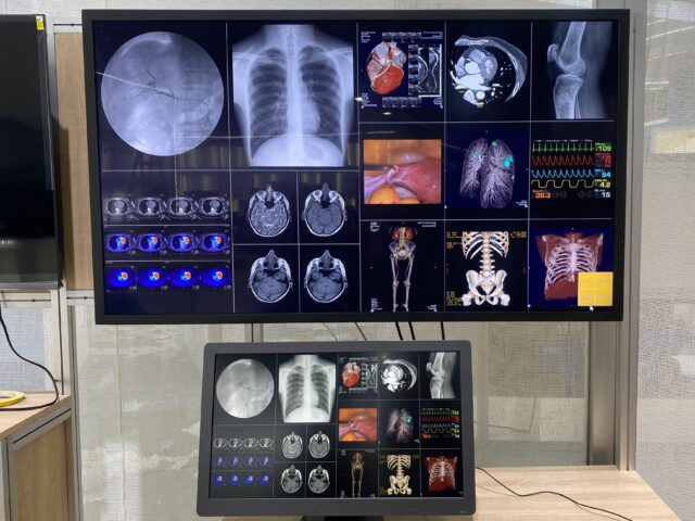 台灣新聞通訊社-鈺緯首度亮相 Mini LED 醫療顯示器 搶攻國際 Tier1醫療大單