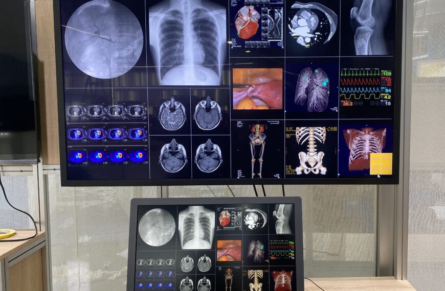 台灣新聞通訊社-鈺緯首度亮相 Mini LED 醫療顯示器 搶攻國際 Tier1醫療大單