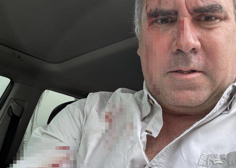 台灣新聞通訊社-秘魯總統參選人遇槍擊受傷 反擊歹徒成功脫險