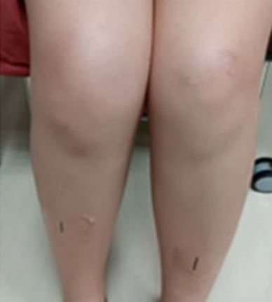 台灣新聞通訊社-25歲女首踩飛輪狂操！竟解「茶色尿、大腿腫」醫示警：恐腎衰危及生命