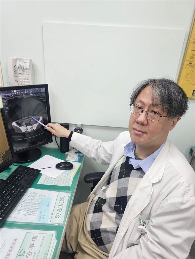 台灣新聞通訊社-45歲女劇烈腹痛1個月狂吐　驚見「小腸套疊」如望遠鏡　醫揪出罕見腫瘤