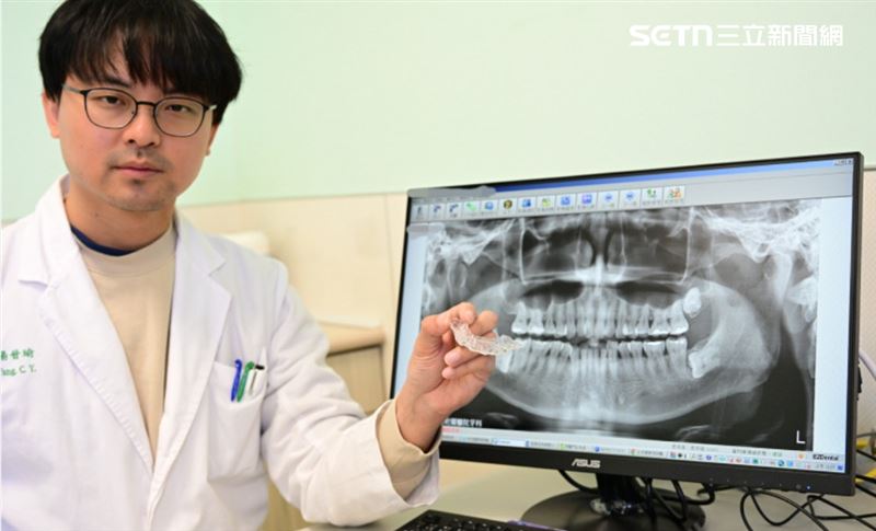 台灣新聞通訊社-牙齒變長好醜？老闆娘壓力大狂磨牙　牙齦萎縮現大縫　醫教這招救