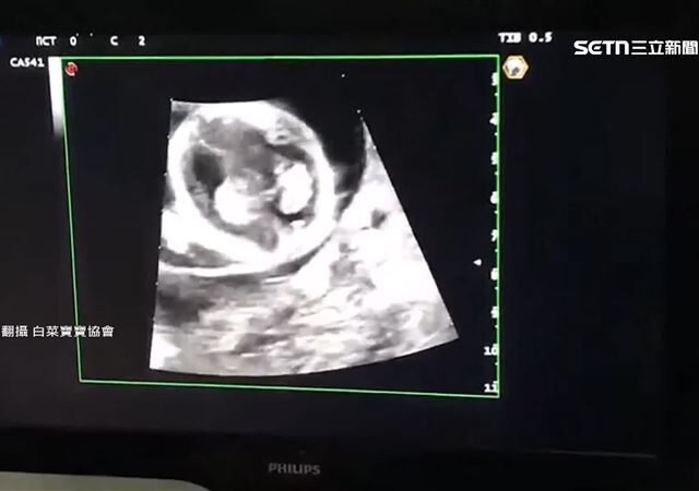 台灣新聞通訊社-代孕踢皮球撈百萬！「白菜寶寶協會」涉詐欺　2人交保、理事長裁定續押