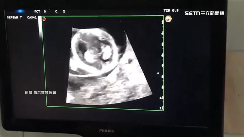 台灣新聞通訊社-代孕踢皮球撈百萬！「白菜寶寶協會」涉詐欺　2人交保、理事長裁定續押