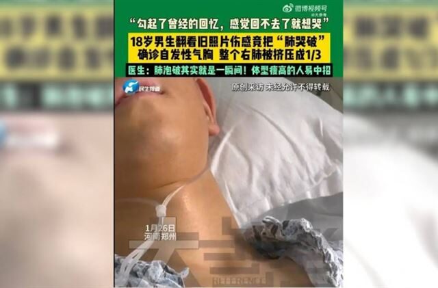 台灣新聞通訊社-男大生半夜翻照片太傷感　情緒激動竟「哭破肺」右肺塌陷剩1/3