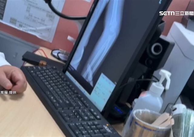 台灣新聞通訊社-獨家／嚇！兒玩夜市充氣床摔斷手開刀　母掉淚自責