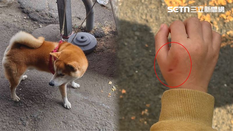 台灣新聞通訊社-柴犬暴衝撕咬…3歲女童虎口「血沿齒痕流」!母心碎吶喊聲喚飼主嘲笑
