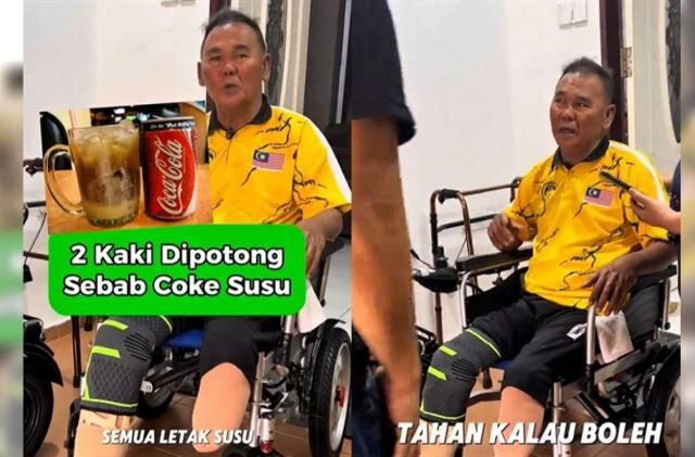 台灣新聞通訊社-中年男每天喝「這飲料」害糖尿病惡化　醫一看嚇壞：只能截肢保命