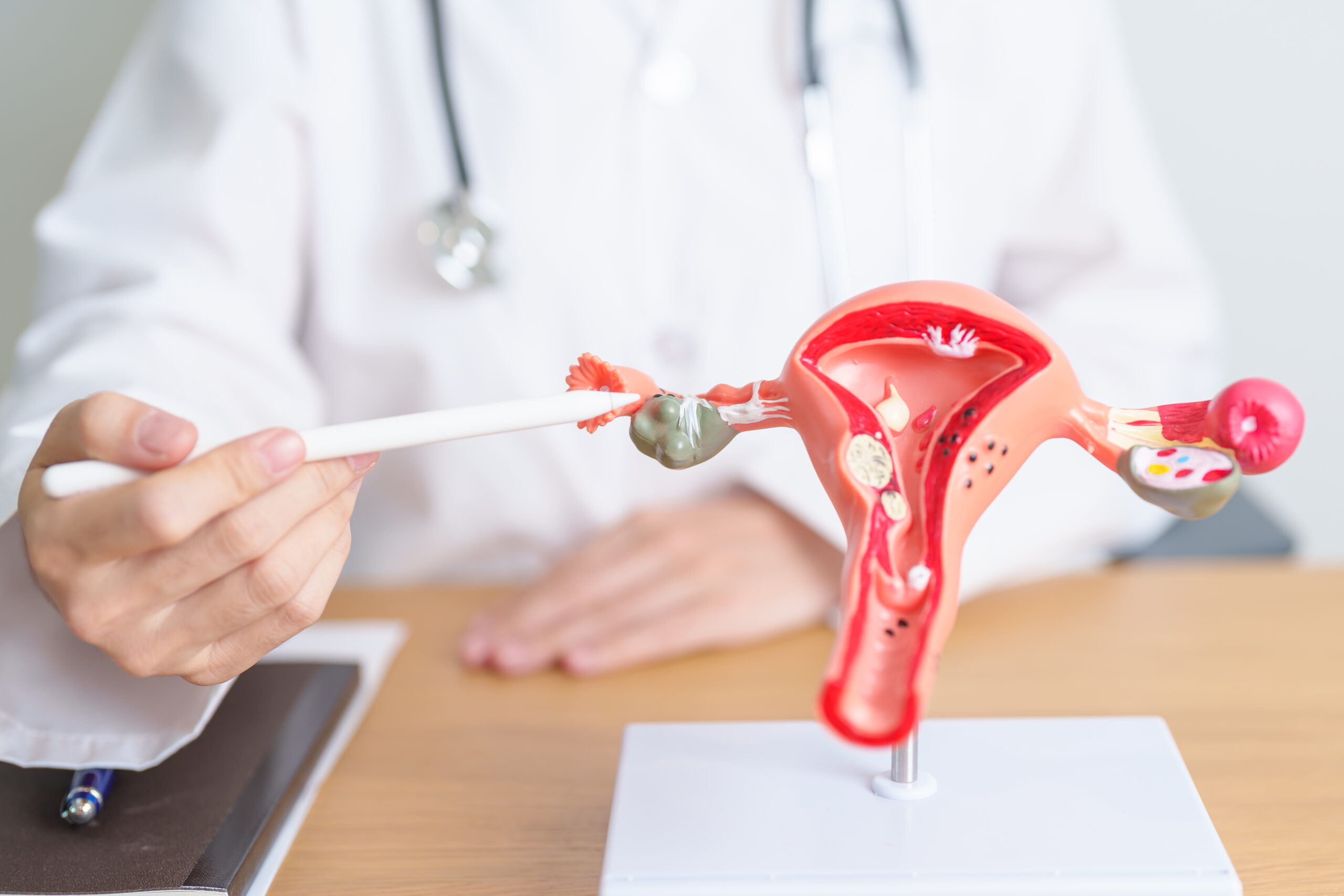 台灣新聞通訊社-「我又沒性行為」成致命迷思！ 40多歲女長期亂經 就醫確診子宮內膜癌