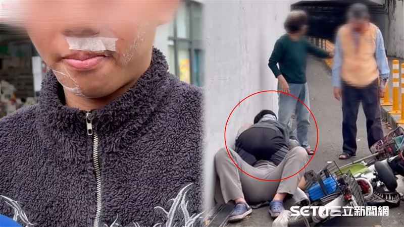 台灣新聞通訊社-惡男逆向撞老夫妻…男大生英勇肉搏「血疤爬滿臉」：吃飯不敢脫口罩