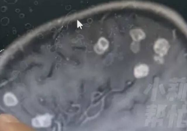 台灣新聞通訊社-大掃除完6歲妹狂燒17天！檢查驚見「腦被啃出20個洞」　醫揭恐怖元凶