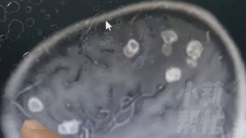 台灣新聞通訊社-大掃除完6歲妹狂燒17天！檢查驚見「腦被啃出20個洞」　醫揭恐怖元凶