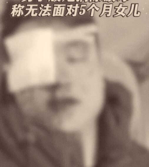 台灣新聞通訊社-樂極生悲！新手爸過年放煙火竟「炸碎眼球」急送醫摘眼保命