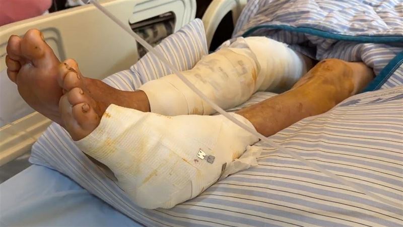 台灣新聞通訊社-彰化嬤遭圍攻慘留200齒痕！警發惡狗追緝令 借力「郵差地圖」鎖定10惡犬