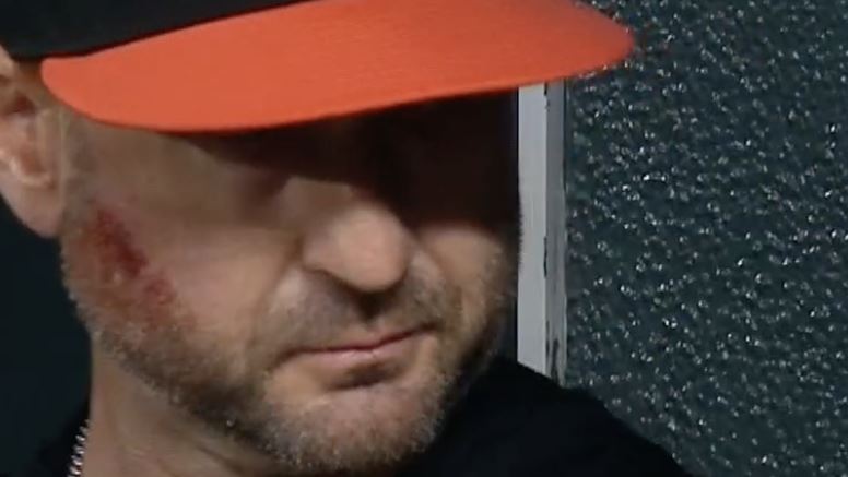 台灣新聞通訊社-MLB／金鶯總教練被自家球員擊中臉　傑克森內疚轟滿貫彈助隊逆轉勝