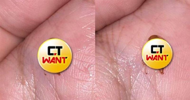 台灣新聞通訊社-男友喉嚨卡3天咳出「詭異生物」嚇壞　全網見畫面抖爆：不如不知道