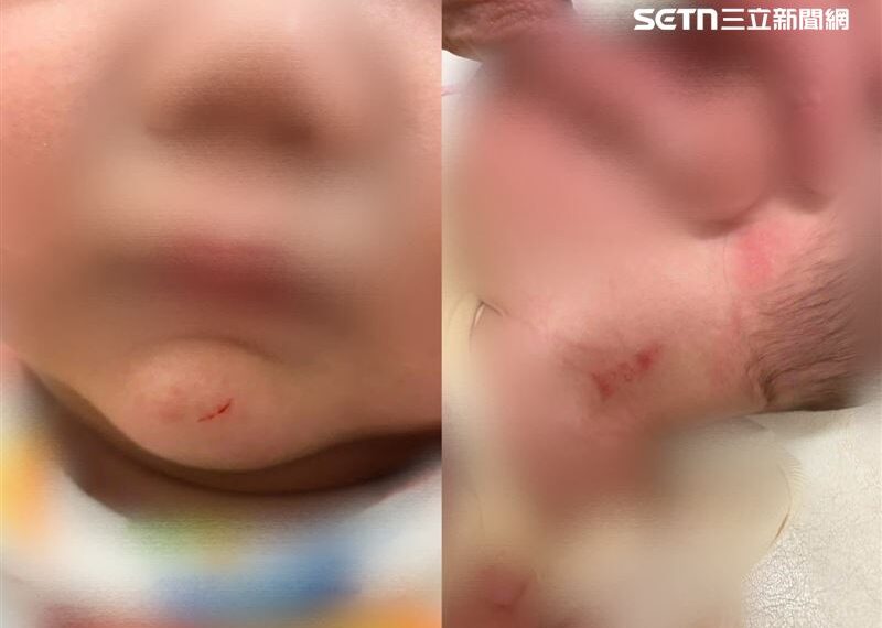 台灣新聞通訊社-虐嬰21次害「顱內出血＋偏癱＋視力聽損」住ICU　台南惡保母下場曝光