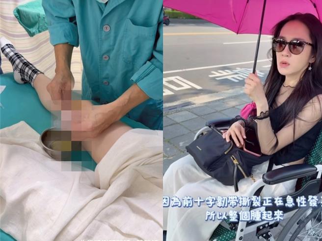 台灣新聞通訊社-楊千霈演出前突不能走路！「坐輪椅掛急診」長針抽積水痛尖叫