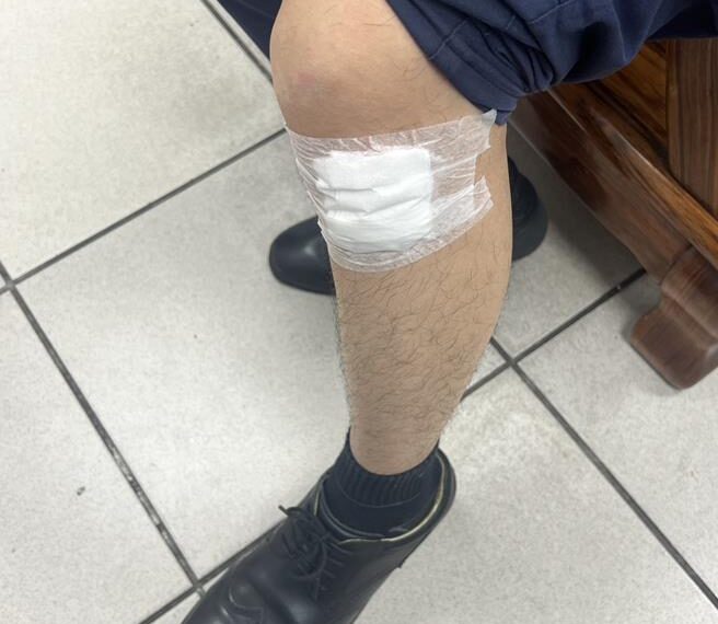台灣新聞通訊社-毒駕男沿路蛇行遭攔想逃 永和分局2警制止遭撞輕傷