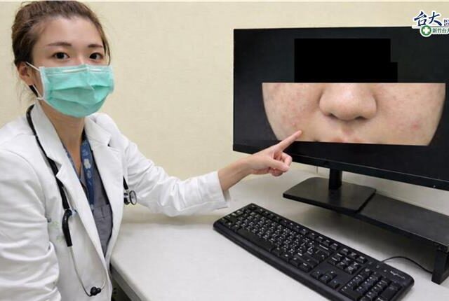 台灣新聞通訊社-10歲女童突全身紅疹 醫示警：恐是過敏性休克前兆