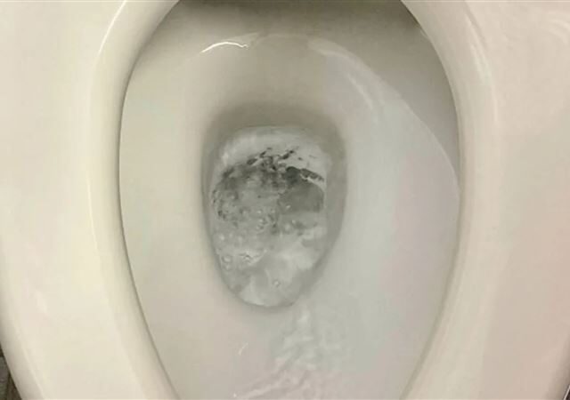 台灣新聞通訊社-40歲女肛門癢翻！醫一看搖頭了　點1清潔習慣：濕紙巾害的