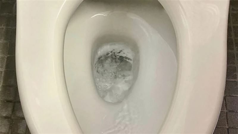 台灣新聞通訊社-40歲女肛門癢翻！醫一看搖頭了　點1清潔習慣：濕紙巾害的