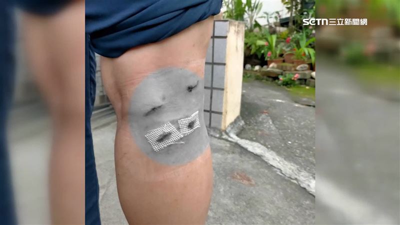 台灣新聞通訊社-2惡霸猴王咬傷腿居民濺血 侵門踏戶露齒示威