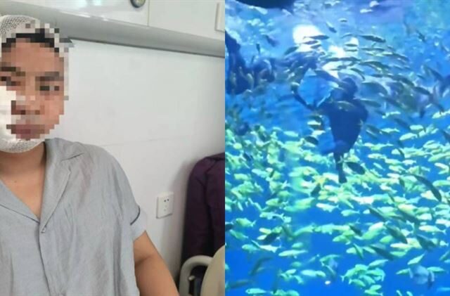 台灣新聞通訊社-宣稱「兒童也能玩」！　男體驗潛水竟遭3公尺鯊魚咬傷頭