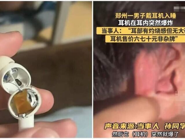台灣新聞通訊社-中國熱銷耳機竟爆炸！男大生險失聰　中網友酸：摩薩德炸Call機輸了