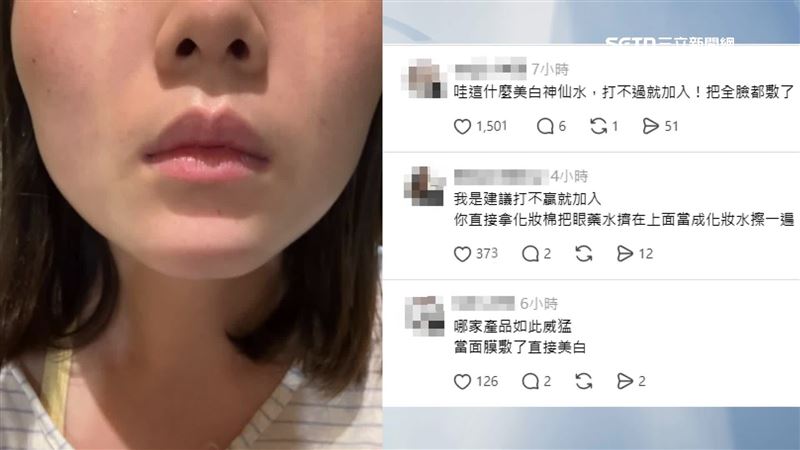 台灣新聞通訊社-獨家／眼藥水美白？女滴完膚色變白　網歪樓：想敷臉