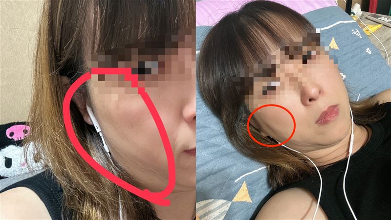 台灣新聞通訊社-台中女醫美埋線感染⋯怒告：術後不理！診所反控：攜伴大嗆「店長踹共」