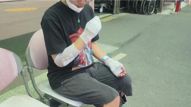 台灣新聞通訊社-又爆人狗衝突 彰化男公園運動遭野狗追逐慘摔