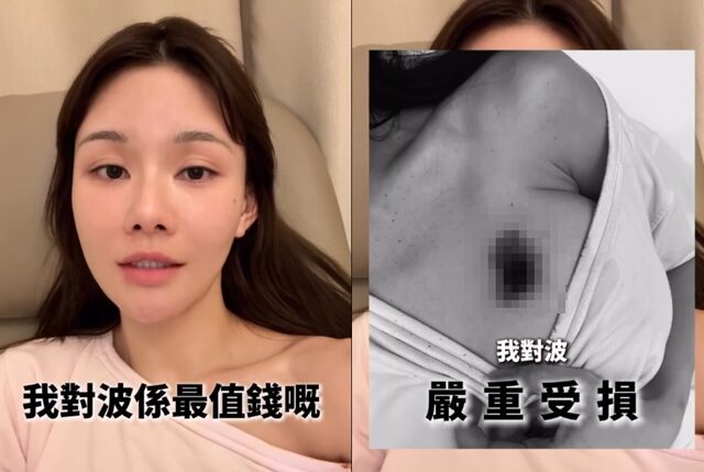 台灣新聞通訊社-香港富商小三抱怨遭熱水袋燙傷 拉開上衣：我這對胸最值錢