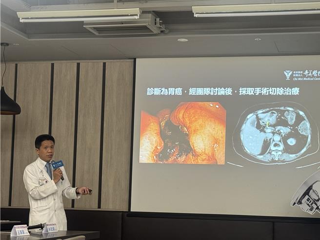 台灣新聞通訊社-食慾不佳、上腹悶痛?85歲阿嬤竟是胃癌3期