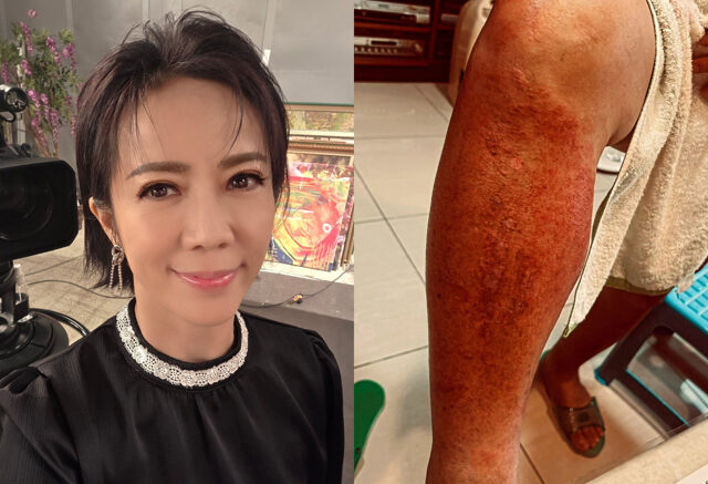 台灣新聞通訊社-陳仙梅爸爸突爆蜂窩性組織炎住院！疑血糖過高引起急壞全家